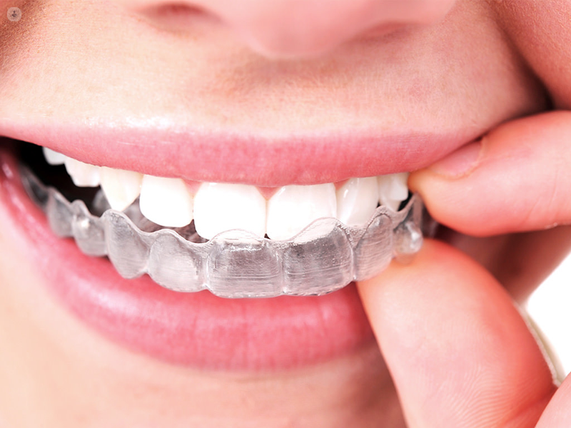 Invisalign Available near London, Ontario 