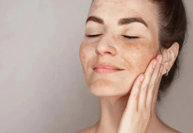 Key Ingredients To Consider When Choosing Dark Spot Treatments For Skin